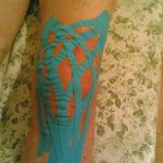 kinesiotaping drenante