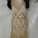 effetto recoil kinesiotaping