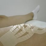 convoluzioni kinesiotaping