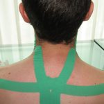 kinesiotaping trapezi cervicalgia