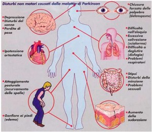 morbo di parkinson rigidità