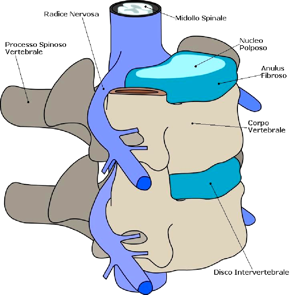 stenosi-canale-vertebrale1