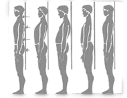 rieducazione posturale- quando farla